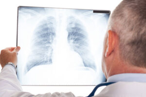 Cancer Misdiagnosis Claims